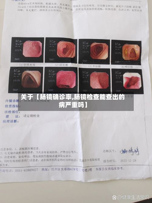 关于【肠镜确诊率,肠镜检查能查出的病严重吗】