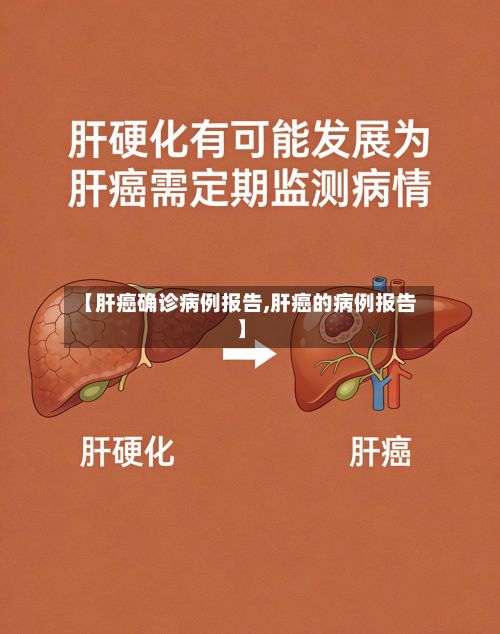 【肝癌确诊病例报告,肝癌的病例报告】-第3张图片